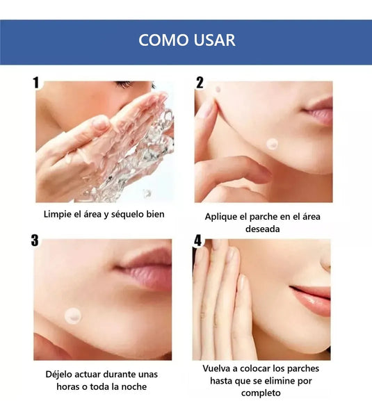 SkinClear™ – Parches para Verrugas